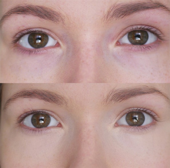 Catrice Allround Concealer